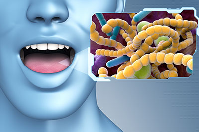 An illustration of a human mouth with a microscopic view of bacteria superimposed, highlighting the concept of oral health and bacterial infection.