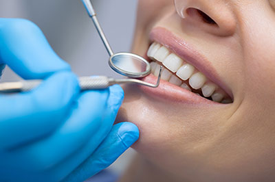A dental professional performing a teeth cleaning procedure on a patient, with the patient's mouth open and a toothbrush in use.