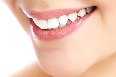 The image shows a close-up of a person's smiling face, with a focus on their teeth and lips.