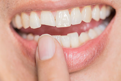 An image of a person's hand holding a toothbrush near their mouth, with a close-up view of a smiling mouth revealing white teeth and tongue.