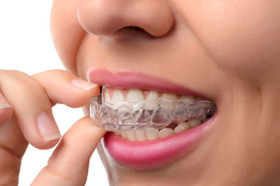 The image shows a person's hand holding a toothbrush with bristles, and the bristles are being chewed by a mouth wearing clear orthodontic aligners.