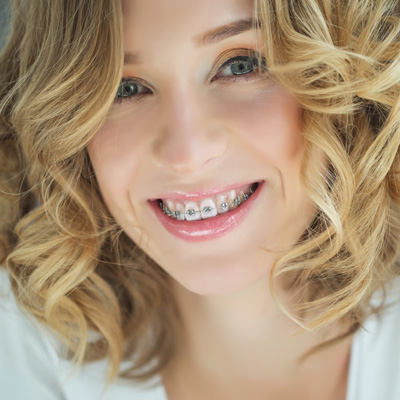 The image shows a woman with braces, smiling at the camera.